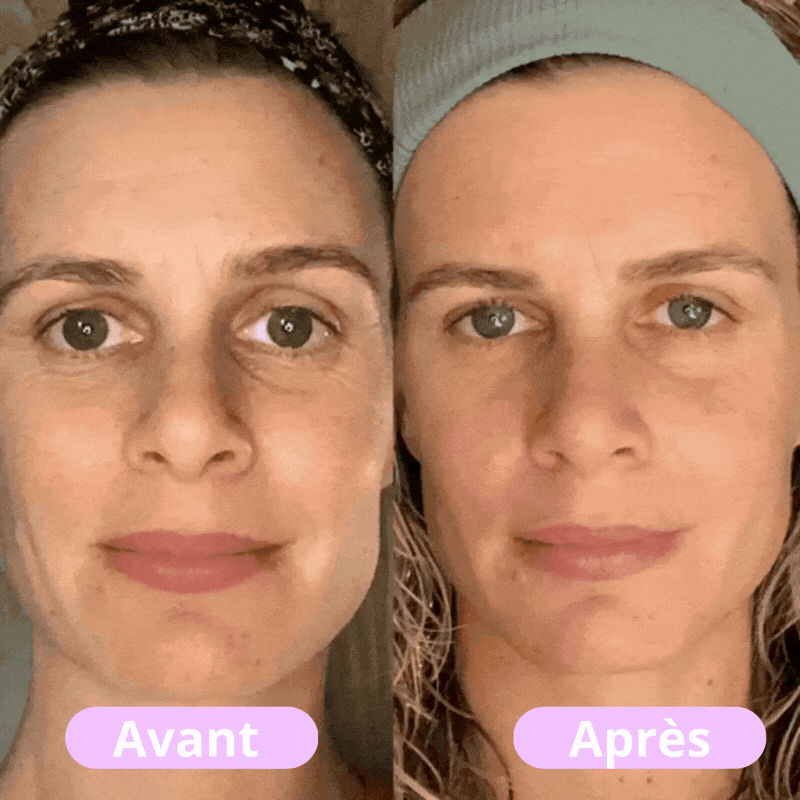 Ivret - Masseur facial LED tonifiant
